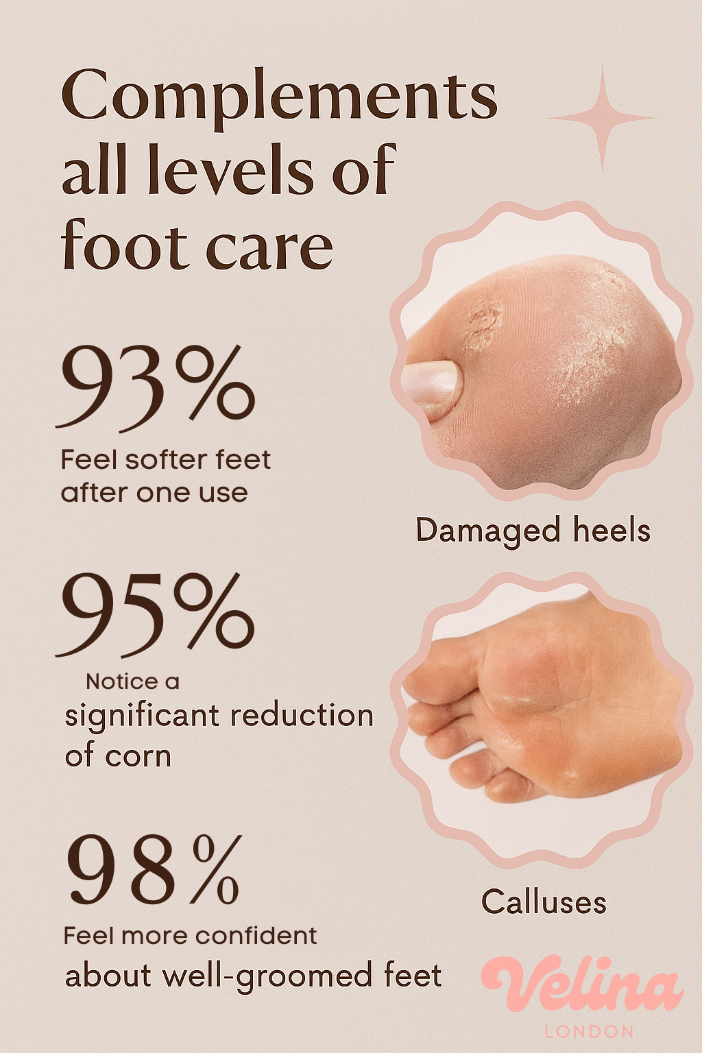 Velina London™ – Professional Pedicure Tool