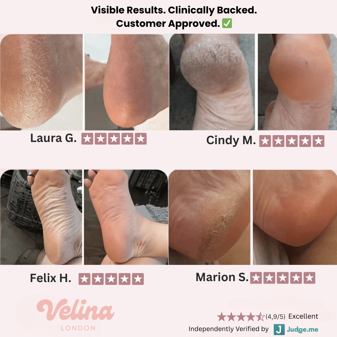 Velina London™ – Professional Pedicure Tool